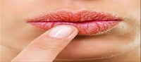 Home Remedies for Chapped Lips!!!